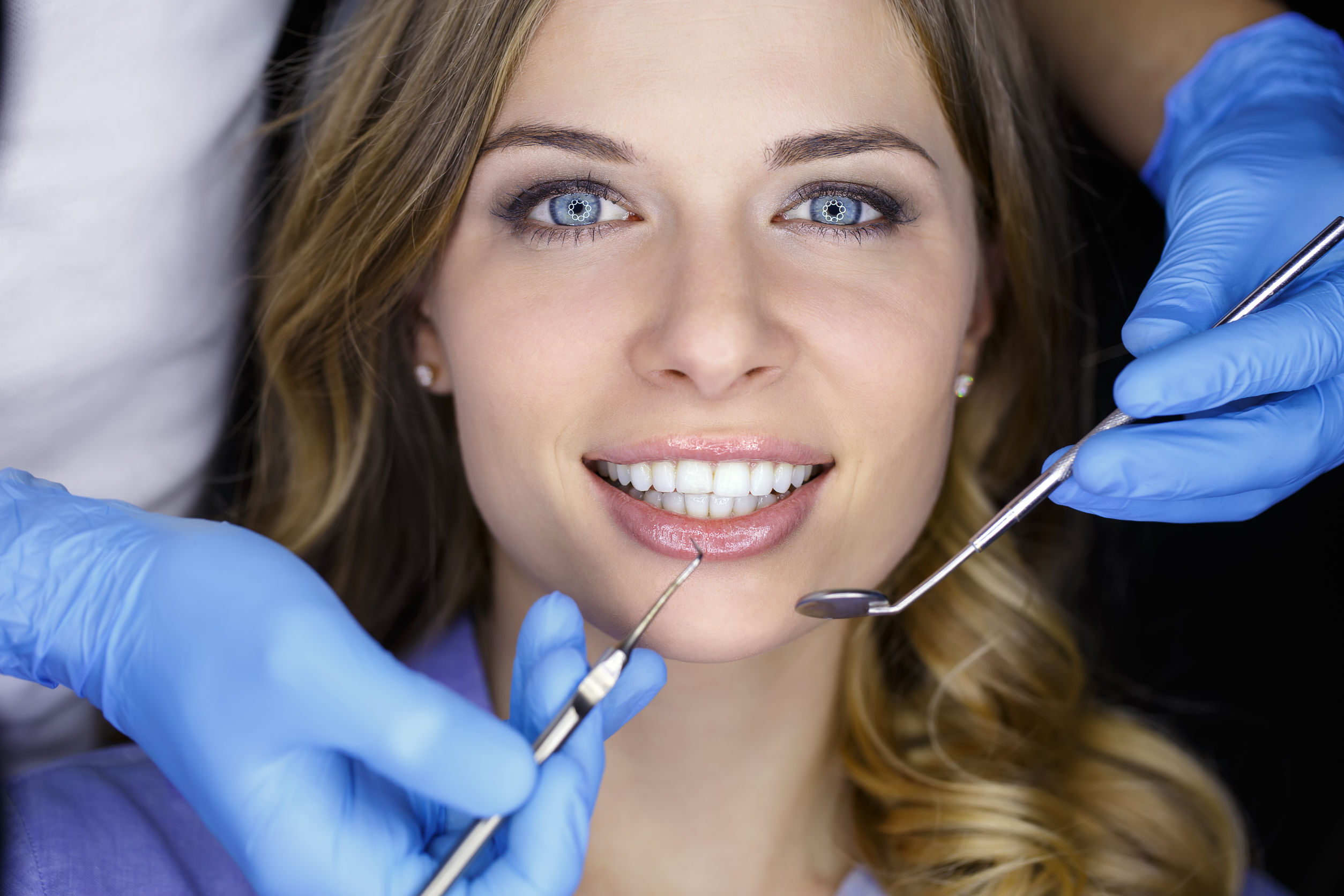 Dental fillings by family dentist in 76177 Fort Worth, TX